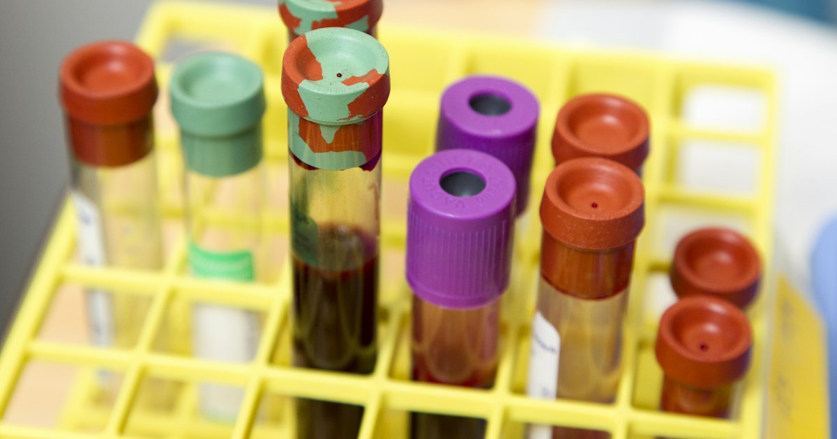 L-Tyrosine or N-Acetyl-L-Tyrosine: What Is the Difference